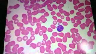 6 SANGRE Y HEMATOPOYESIS Reconocimiento de laminas histologicas UMSA [upl. by Carvey400]