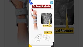 Must Know Tests In Orthopedics [upl. by Nezam]