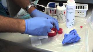 Denture Soft Reline Part 1 [upl. by Corbin]