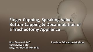 Finger Capping Speaking Valve ButtonCapping amp Decannulation of a Tracheotomy Appliance [upl. by Ede]