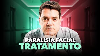 Paralisia Facial de Bell  Qual o Melhor Tratamento [upl. by Toffey]