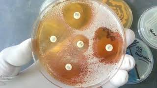 Candida tropicalis and its Laboratory Diagnosis [upl. by Abbottson]