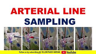 Arterial line sampling  ABG sampling from Arterial line Arterial line sampling procedure [upl. by Cletis]