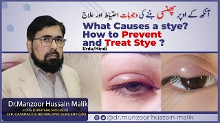 What causes a stye prevention and treatment  in Urdu Hindi [upl. by Toombs10]