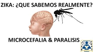 Zika Microcefalia y Sindrome de Guillain Barre [upl. by Hillell]