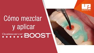 Cómo mezclar y aplicar el blanqueamiento dental médico Opalescence™ Boost™ [upl. by Edmanda]