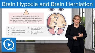 Brain Hypoxia and Brain Herniation – MedSurg Nursing  Lecturio [upl. by Gardie]