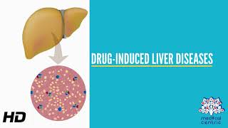 DrugInduced Liver Disease Causes Signs and Symptoms Diagnosis and Treatment [upl. by Enyedy]