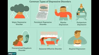 Trattamenti per la depressione maggiore [upl. by Orsini]