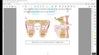 Etiology of Malocclusion Lecture 2 Part 1 [upl. by Strander]