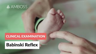 Babinski Reflex in Infants  Clinical Examination [upl. by Estrellita]