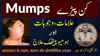 Mumps کن پیڑے कण्ठमाला का रोग Homeopathic Treatment Symptoms by DrWaqar Bhutta  Urdu  Hindi [upl. by Olgnaed924]