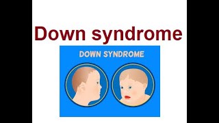 Understanding Down Syndrome Causes amp Treatments  2024 [upl. by Ardnu]