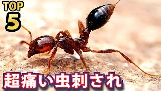 刺されると強烈に痛い虫ＴＯＰ５ランキング！刺されると世界一痛い虫は刺して噛む！？ [upl. by Enilreug]