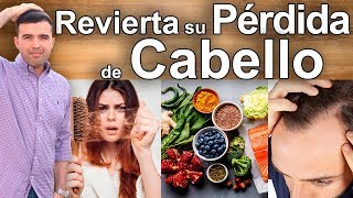 Como Detener la Caida de Cabello  Tratamiento Natural Para la Perdida de Cabello [upl. by Reese]