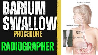 Barium Swallow Procedure  How to do Barium Swallow  Radiographer  X RAY Radiographer  Radiology [upl. by Enitsed]