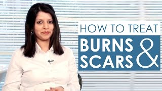 How to Treat Burns and Scars [upl. by Nnovahs]