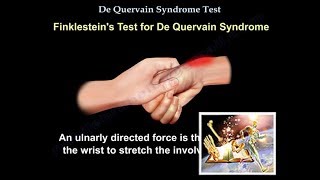 De Quervain Syndrome Test  Everything You Need To Know  Dr Nabil Ebraheim [upl. by Asinet550]