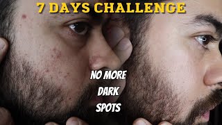 In 7 days Remove Dark Spots NO CLICKBAIT 100 REAL RESULTS [upl. by Ober138]