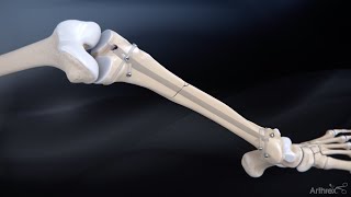 Ankle Joint  3D Anatomy Tutorial [upl. by Maillij]