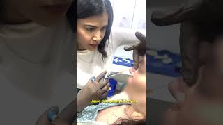 Want a slimmer and sharper 👃 Nose 👩‍⚕ Dr Priyanka Reddy  DNA Skin Clinic  shorts nosejob [upl. by Attenal]