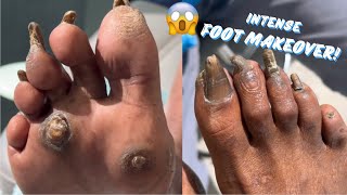 INTENSE FOOT MAKEOVER  PART 1 [upl. by Three]