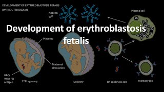 Erythroblastosis fetalis development [upl. by Yttisahc785]