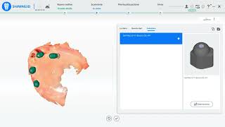 Innovazione e Precisione in Chirurgia Odontoiatrica con il nuovo scanner Elite di Shining 3D [upl. by Atilal]