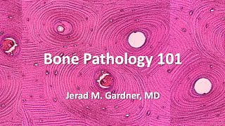 Bone Tumor Pathology 101 Osteosarcoma Chondrosarcoma and Mimics [upl. by Enelyk]