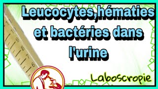 leucocytes hématies et bactérie dans lurine [upl. by Schellens457]