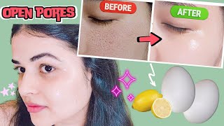 DIY Egg  Lemon Face Mask  Skin Whitening Face Pack  Close Large OPEN PORES amp Remove Wrinkles [upl. by Krell]