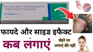 Dermiford Cream  dermiford cream kis kaam aati hai  Dermiford cream uses in Hindi  Side Effects [upl. by Primaveria]