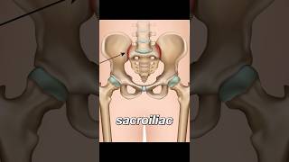 Sacroiliitis  lower back pain [upl. by Henden770]