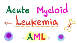 Acute Myeloid Leukemia AML  Auer Rods  Myeloperoxidase Positive  Hematology amp Oncology Series [upl. by Assenej]