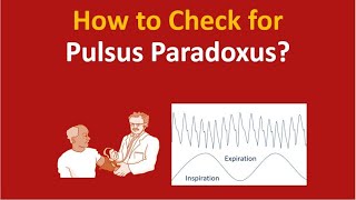 How to check for pulsus paradoxus [upl. by Ramsa823]