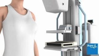 How a mammogram is carried out  Bupa Health [upl. by Atlee673]