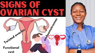 👉10 SignsSymptoms Of Ovarian Cyst [upl. by Akiwak]