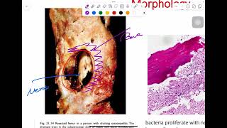 MSS pathology lab 2  part 1 [upl. by Silberman457]