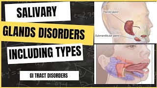 Salivary glands disorders  Understanding causes symptoms and treatment [upl. by Gayl]