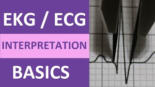 EKGECG Interpretation Basics Nursing NCLEX  QRS Complex P Wave T Wave PR Interval [upl. by Gwenn32]