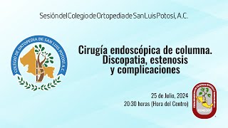 Cirugía endoscópica de columna Discopatia estonosis y complicaciones [upl. by Gilud]