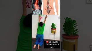 3 exercises for dextroscoliosis Arogya physiotips scoliosis scoliosisawareness [upl. by Menendez]