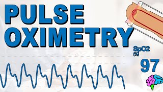 What is Pulse Oximetry [upl. by Nitsed771]