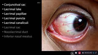 Orbit and Eye  Lacrimal Gland and Tear Pathway [upl. by Nallak]