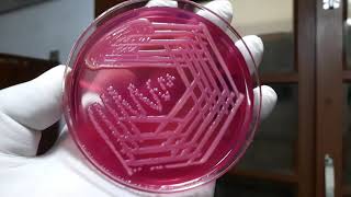 Klebsiella pneumoniae colony morphology on Macconkey agar TSI SIM Urease and Citrate Tests [upl. by Gavan]