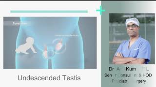 Undescended Testis Cryptorchidism  Sakra World Hospital [upl. by Aufmann]