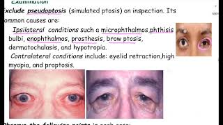 Ptosis lectureComprehensive Ophthalmology lecture A K Khurana [upl. by Germaine]