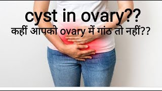 ovarian cyst types of cyst on ovaries By Staypainfreeandhealthy [upl. by Anayt]