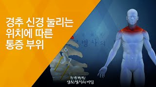 경추 신경 눌리는 위치에 따른 통증 부위  20140917517회 방송우리 몸이 흔들린다 목 질환의 경고 [upl. by Ursulette229]