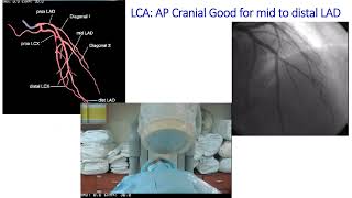 Cardiology Review 2024 part 5  presentation slides [upl. by Siraf]